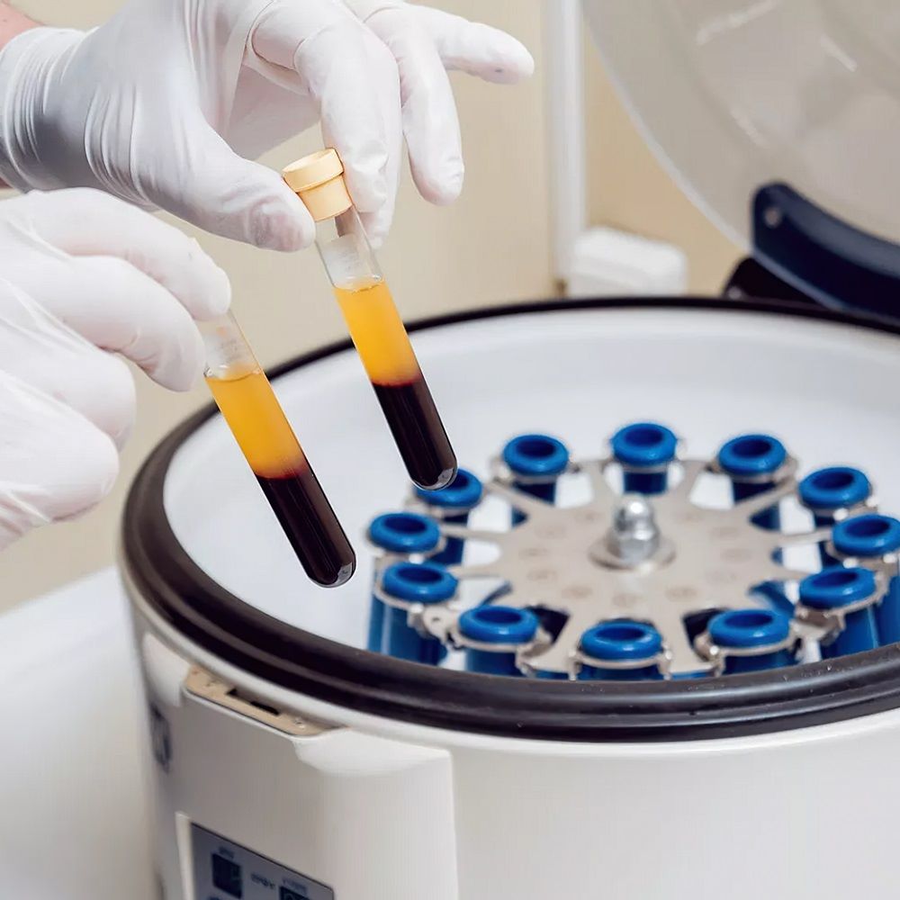 Featured image for “Platelet-Rich Plasma”