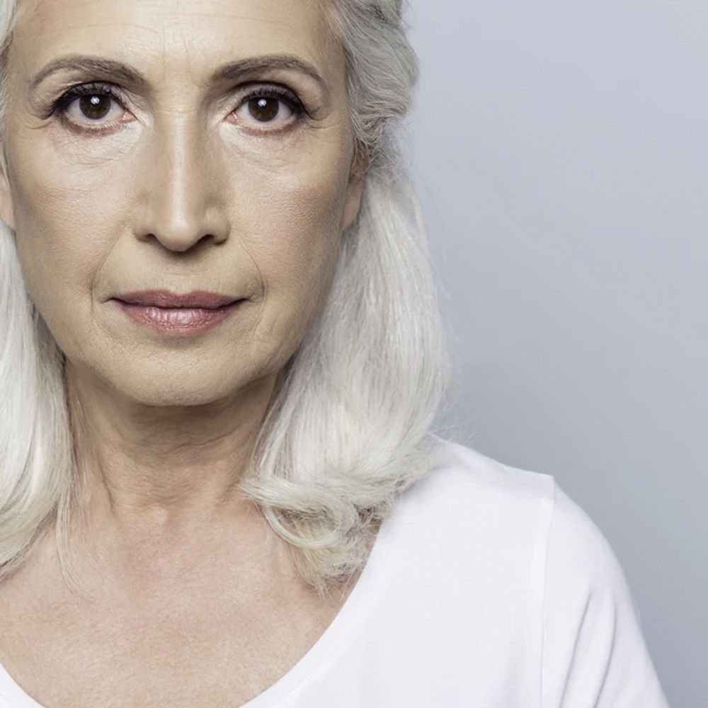 Featured image for “Let’s Talk About Dermal Filler”