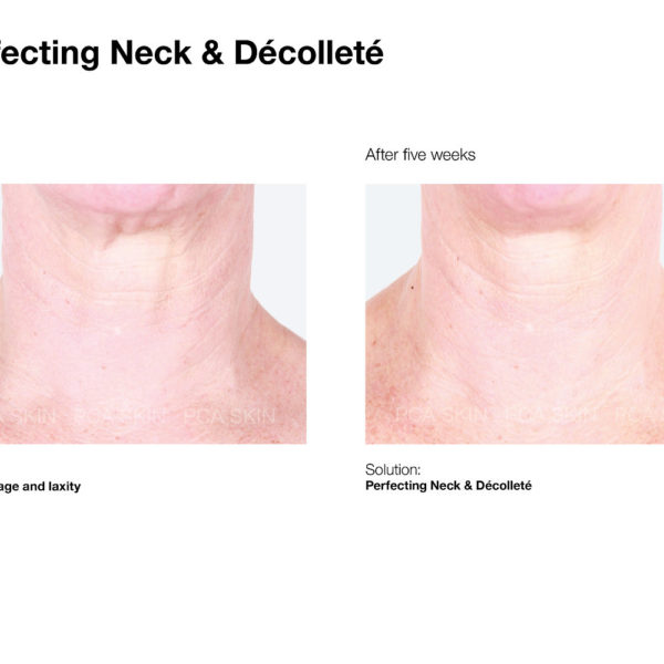 PCA SKIN Perfecting Neck & Décolleté - Image 3